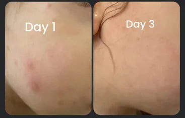 Goddess Radiant Renewal Serum