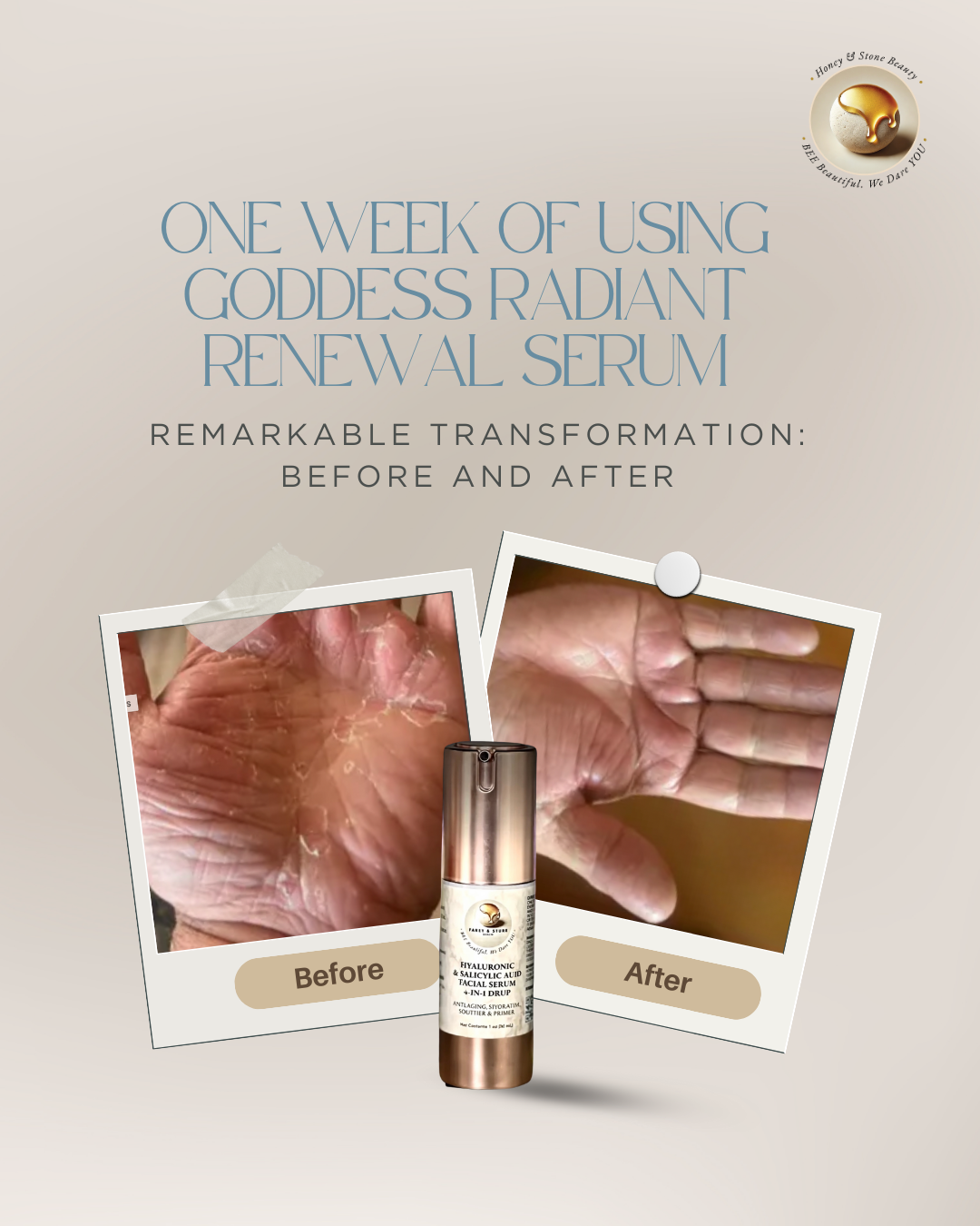 Goddess Radiant Renewal Serum